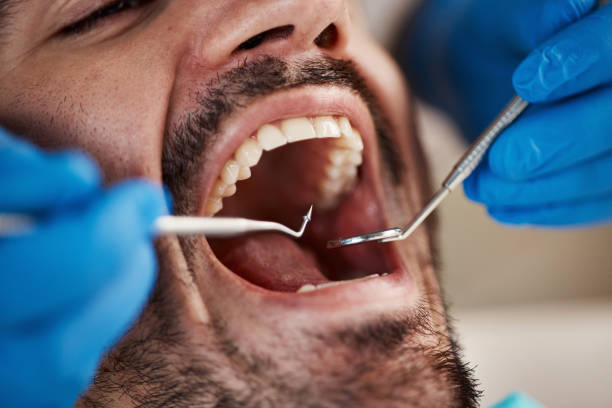  Mcmillin, WA Emergency Dentist Pros