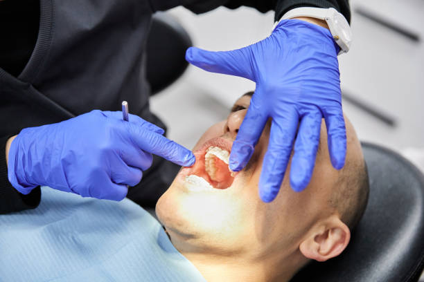 Best Emergency Tooth Extraction in Mcmillin, WA