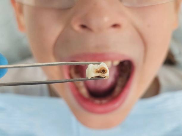 Best Emergency Orthodontic Repairs in Mcmillin, WA
